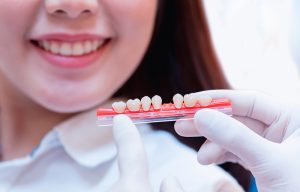 Dientes naturales con Implantes Dentales