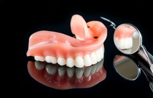 Opciones al perder dientes