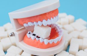 Por qué se producen las caries
