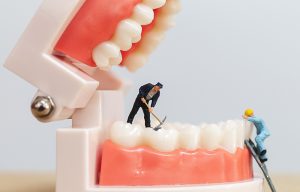 Tips para evitar las caries
